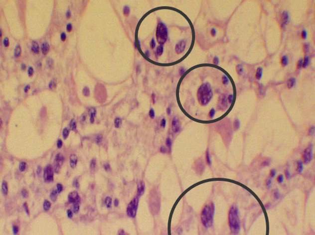 Haplosporidium Costale