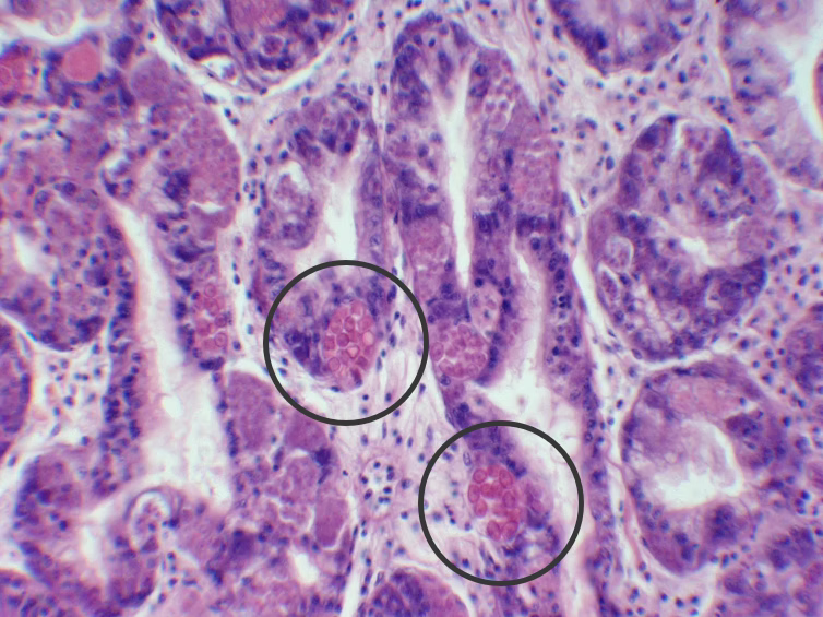 Haplosporidium Nelsoni