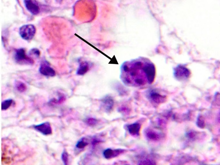 Perkinsus Marinus