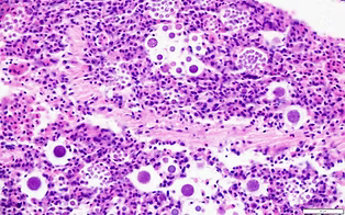 Vibrio parahaemolyticus and Vibrio vulnificus from oysters