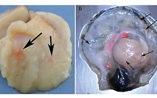 Atlantic sea scallop